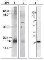 Ferredoxin, apicoplast (Plasmodium falciparum) in the group Antibodies Other Species / Bacteria at Agrisera AB (Antibodies for research) (AS20 4429)